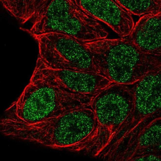 EVX1 Antibody in Immunocytochemistry (ICC/IF)