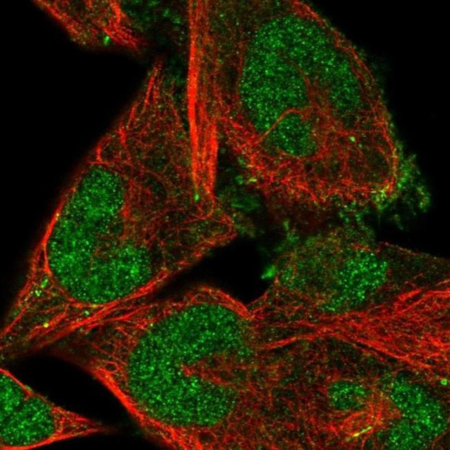 FBXO41 Antibody in Immunocytochemistry (ICC/IF)
