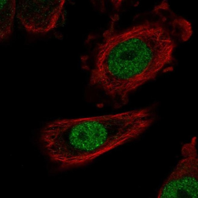 ZHX1 Antibody in Immunocytochemistry (ICC/IF)