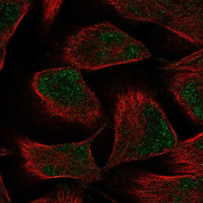 PKNOX2 Antibody in Immunocytochemistry (ICC/IF)