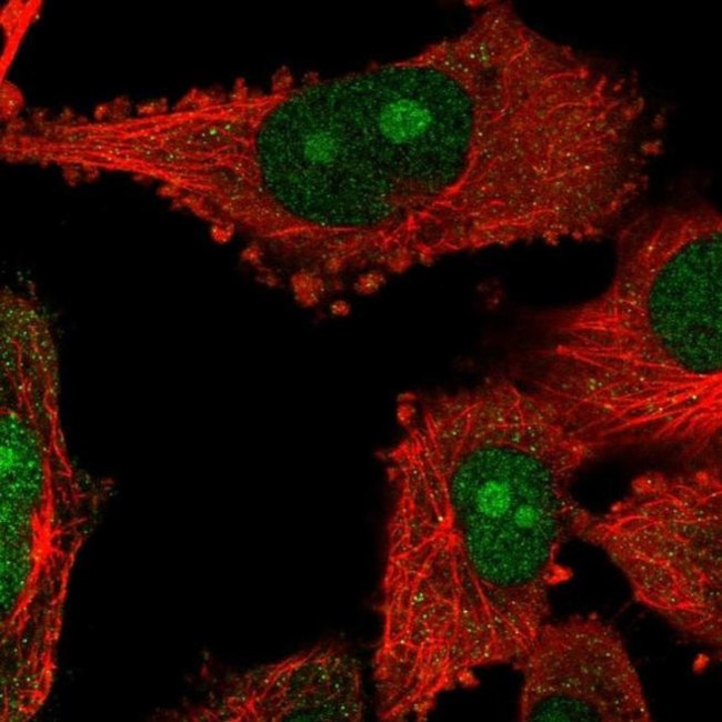 NOP14 Antibody in Immunocytochemistry (ICC/IF)