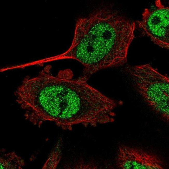 NR2C2AP Antibody in Immunocytochemistry (ICC/IF)