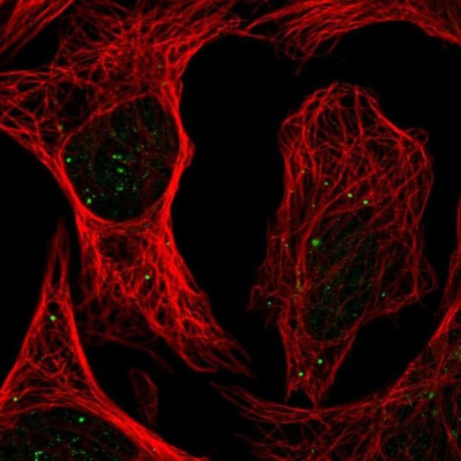 PLAGL1 Antibody in Immunocytochemistry (ICC/IF)