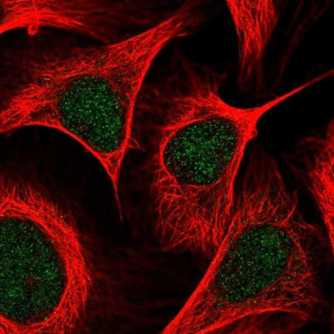 PCAF Antibody in Immunocytochemistry (ICC/IF)