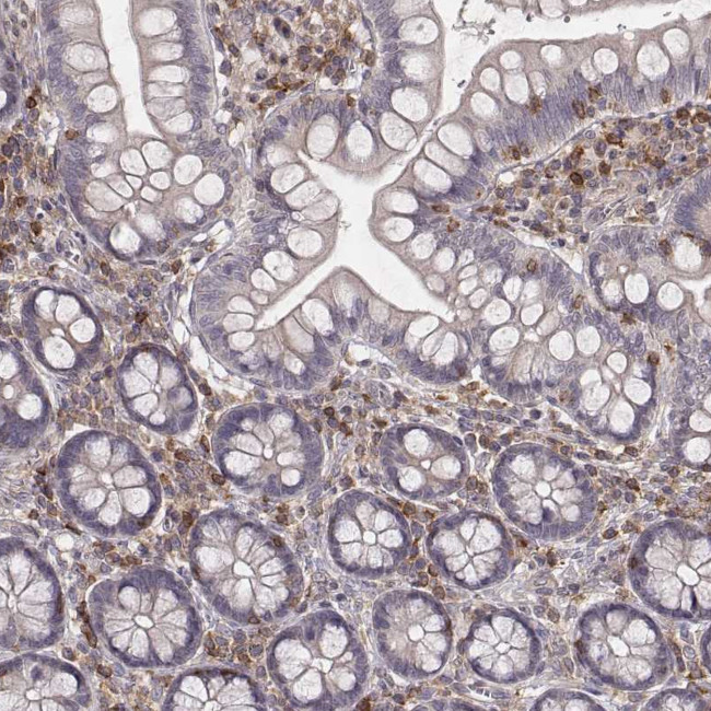 PILRA Antibody in Immunohistochemistry (Paraffin) (IHC (P))