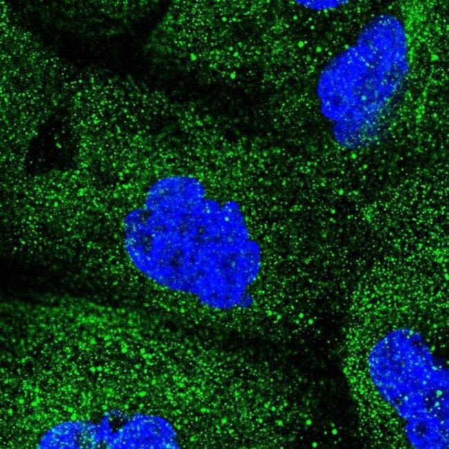COQ2 Antibody in Immunocytochemistry (ICC/IF)