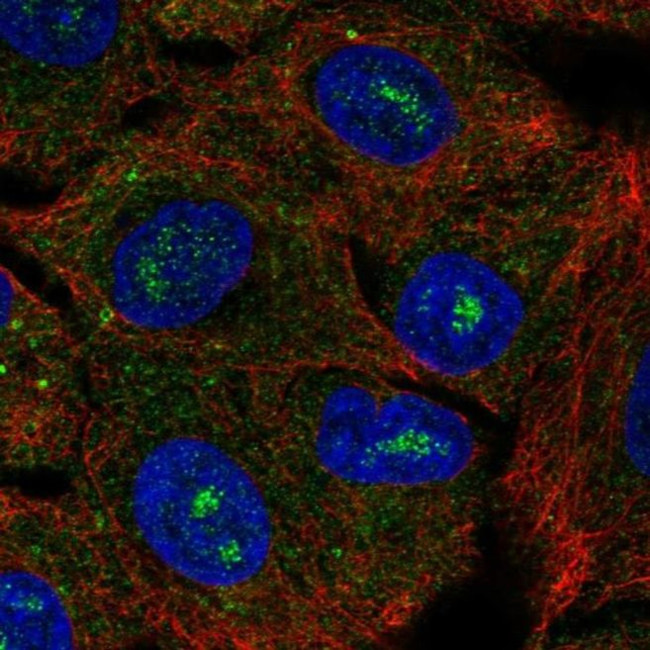 CACNG6 Antibody in Immunocytochemistry (ICC/IF)