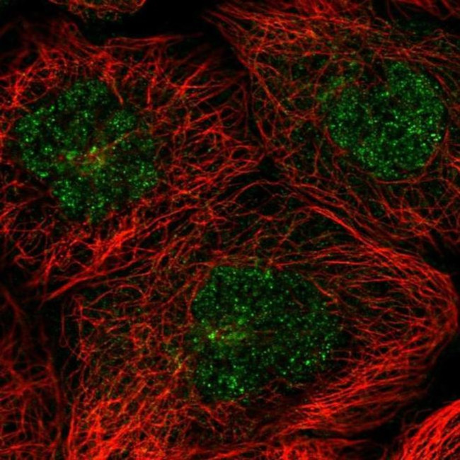 C20orf177 Antibody in Immunocytochemistry (ICC/IF)