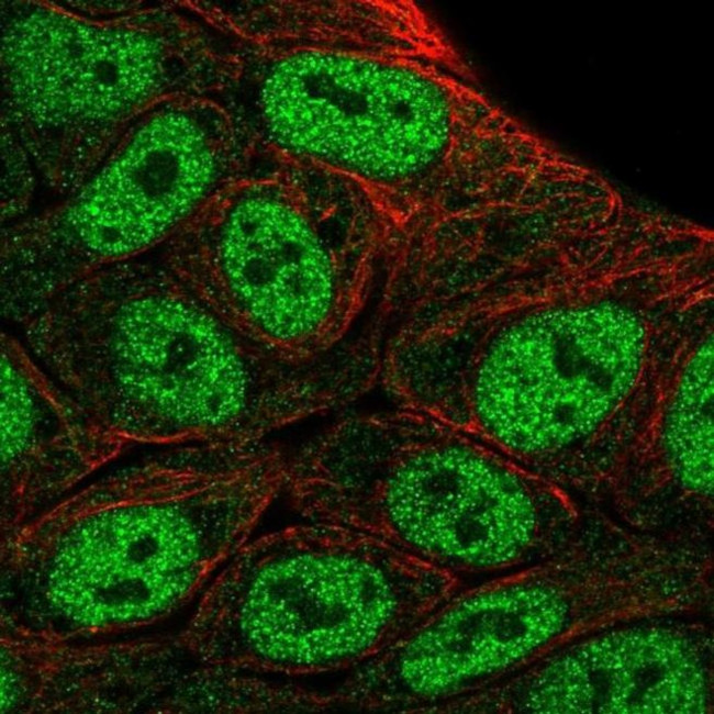 HOXD1 Antibody in Immunocytochemistry (ICC/IF)