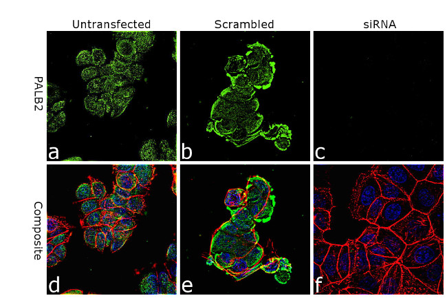 PALB2 Antibody in Immunocytochemistry (ICC/IF)