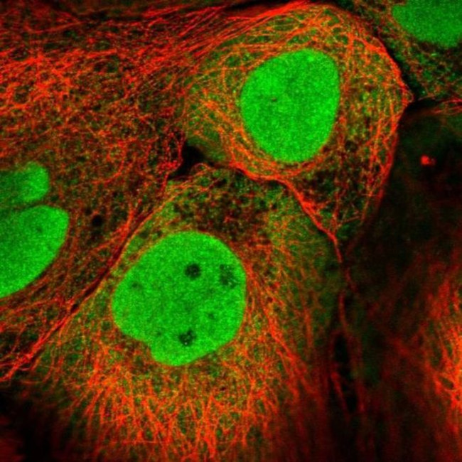 PKNOX1 Antibody in Immunocytochemistry (ICC/IF)