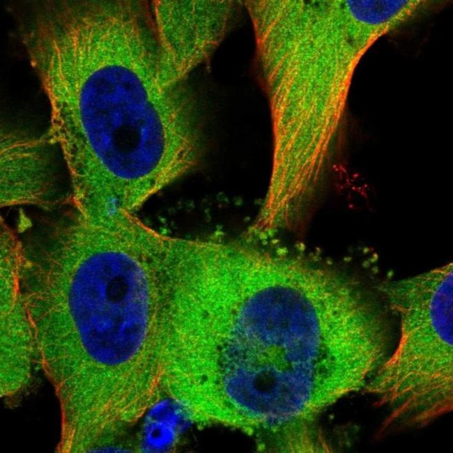 TTC1 Antibody in Immunocytochemistry (ICC/IF)