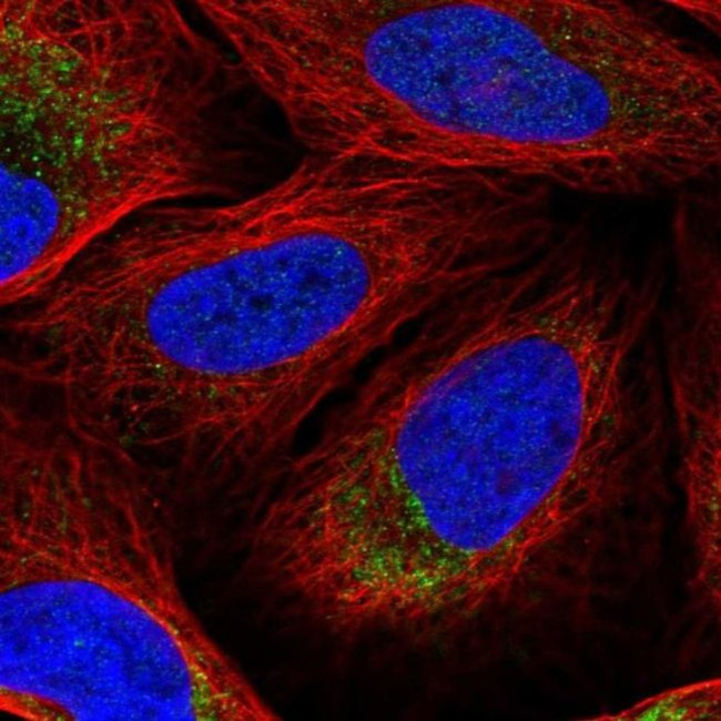 DNA2 Antibody in Immunocytochemistry (ICC/IF)