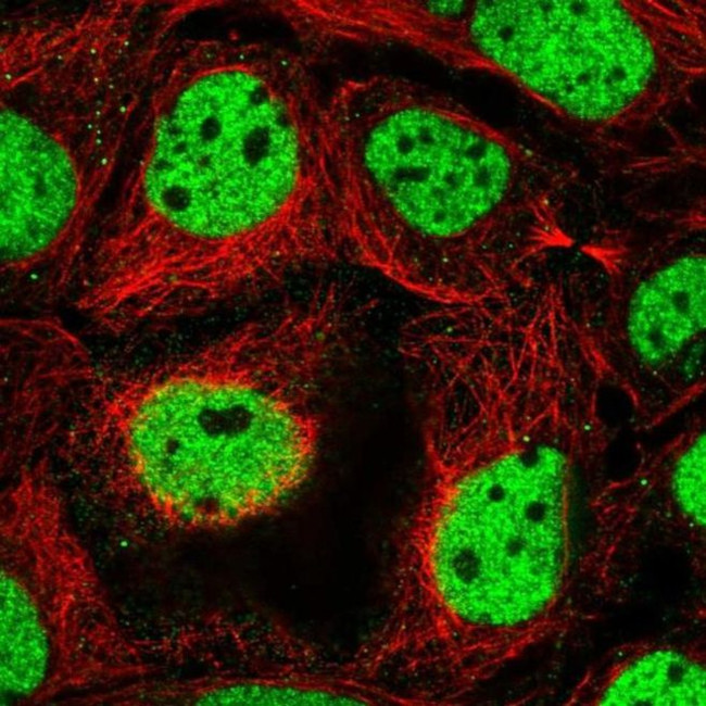 RSF1 Antibody in Immunocytochemistry (ICC/IF)