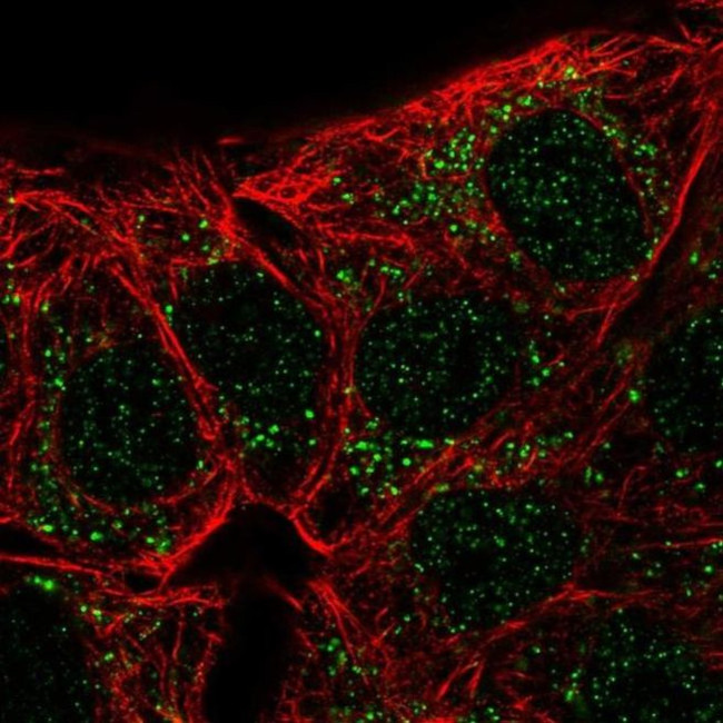 Carbonic Anhydrase X Antibody in Immunocytochemistry (ICC/IF)