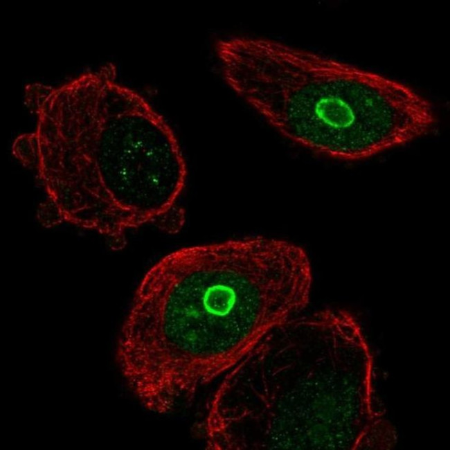 SLC10A7 Antibody in Immunocytochemistry (ICC/IF)