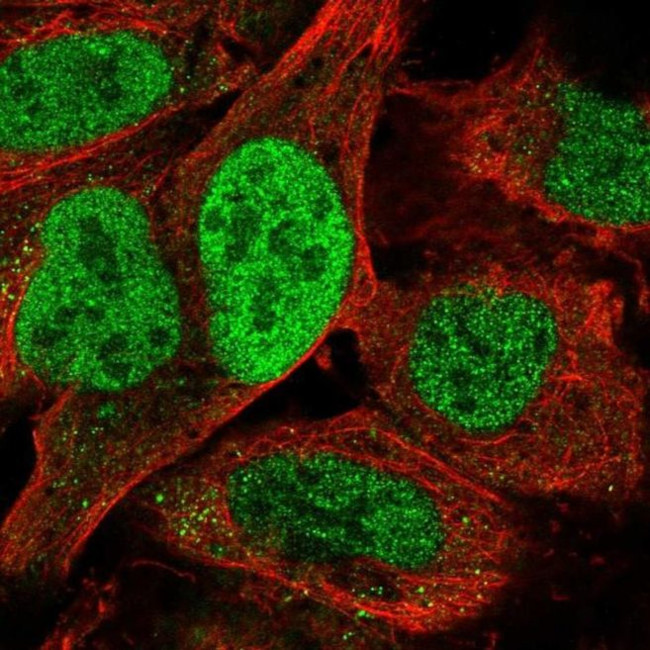 TATD2 Antibody in Immunocytochemistry (ICC/IF)