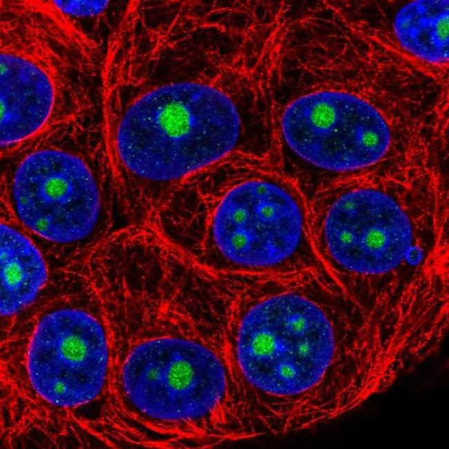 NOP16 Antibody in Immunocytochemistry (ICC/IF)