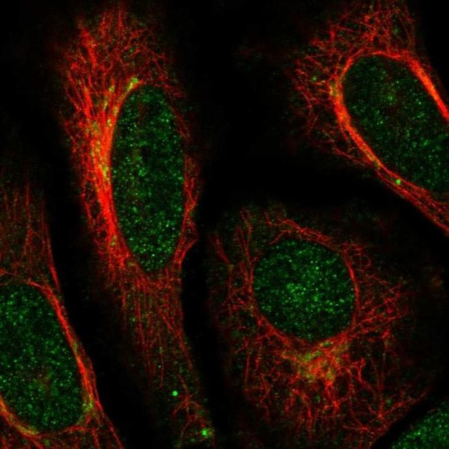 ACAP3 Antibody in Immunocytochemistry (ICC/IF)