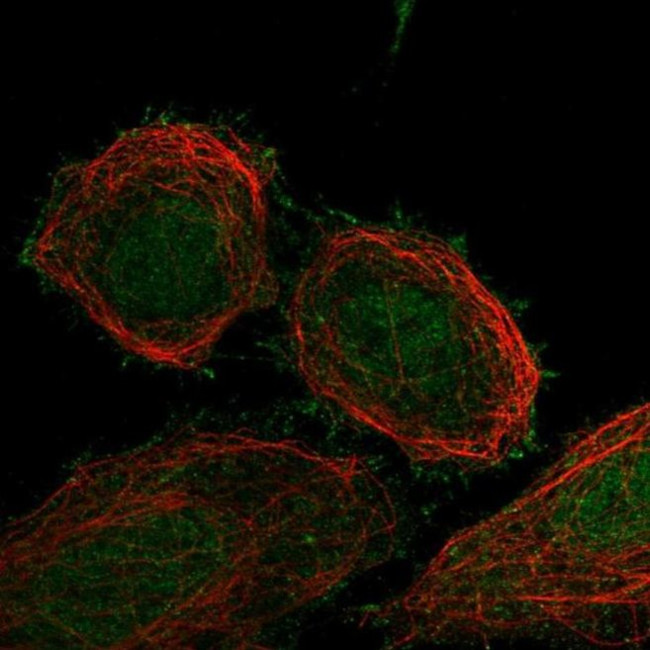FBXO41 Antibody in Immunocytochemistry (ICC/IF)