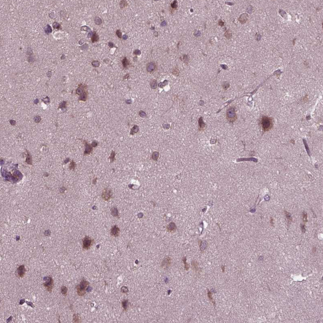 PORCN Antibody in Immunohistochemistry (Paraffin) (IHC (P))