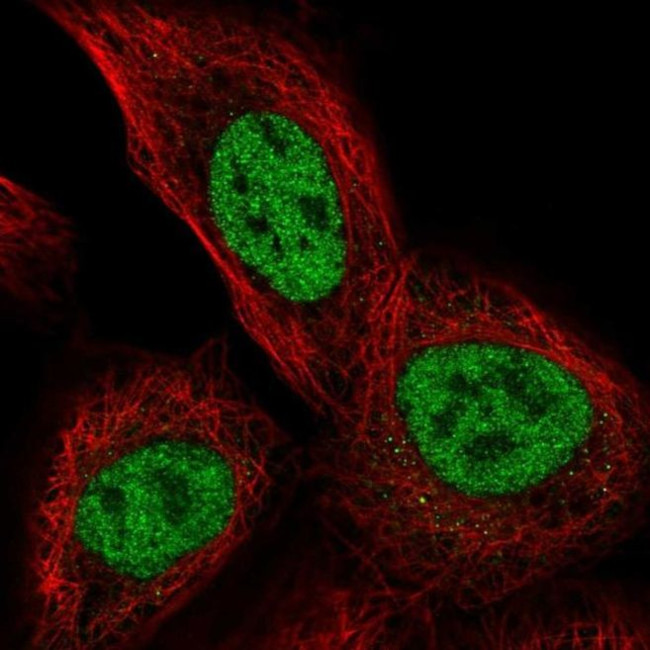 TSSC4 Antibody in Immunocytochemistry (ICC/IF)