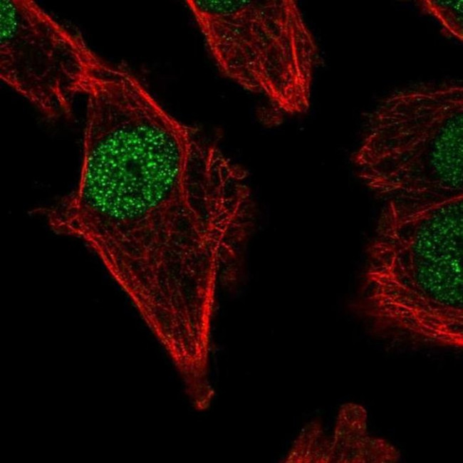 POLM Antibody in Immunocytochemistry (ICC/IF)