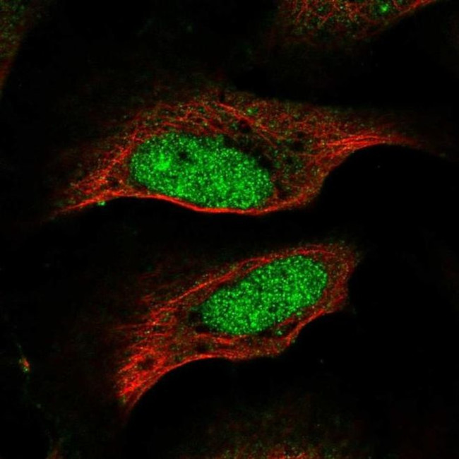 CENPP Antibody in Immunocytochemistry (ICC/IF)