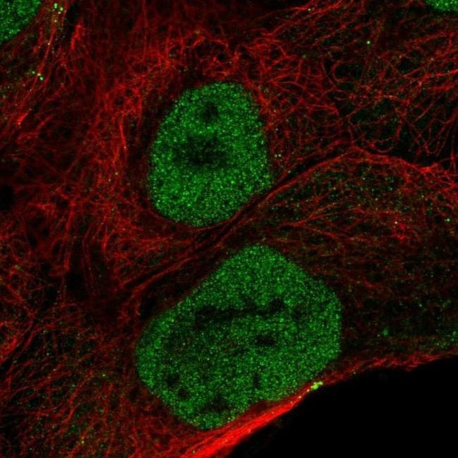 OVCA2 Antibody in Immunocytochemistry (ICC/IF)