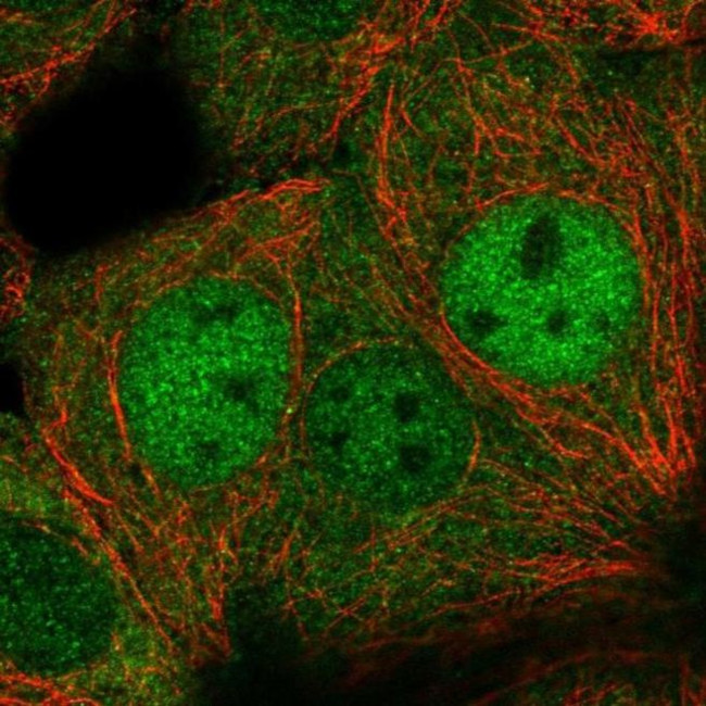 DIP2C Antibody in Immunocytochemistry (ICC/IF)