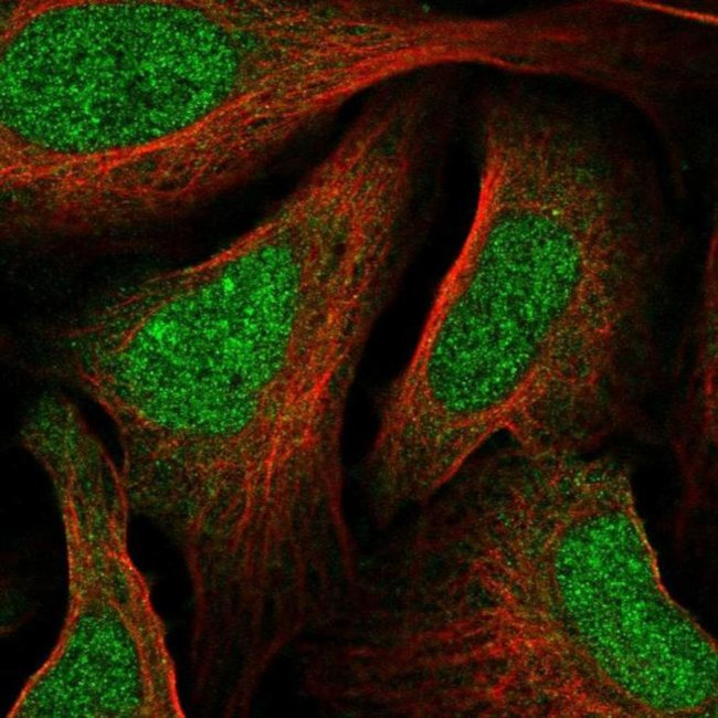 MNT Antibody in Immunocytochemistry (ICC/IF)