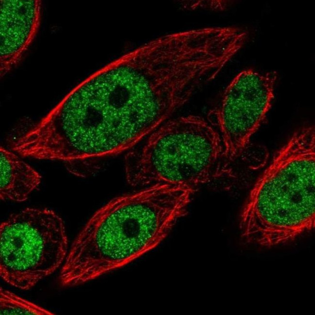 CYHR1 Antibody in Immunocytochemistry (ICC/IF)