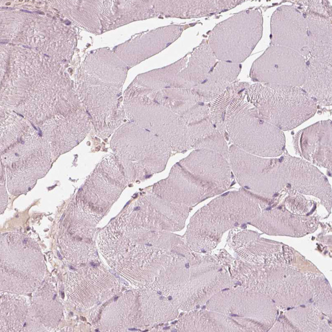 RS1 Antibody in Immunohistochemistry (Paraffin) (IHC (P))