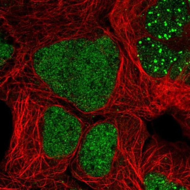 ZNF32 Antibody in Immunocytochemistry (ICC/IF)