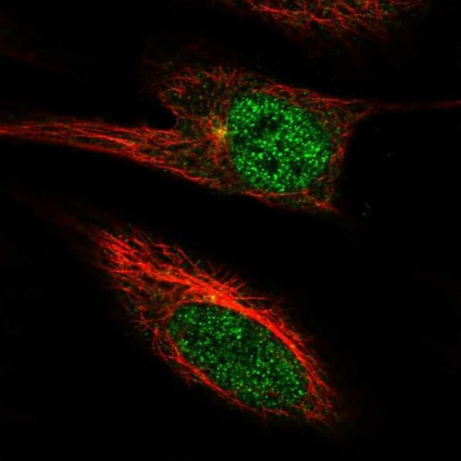 PGBD4 Antibody in Immunocytochemistry (ICC/IF)