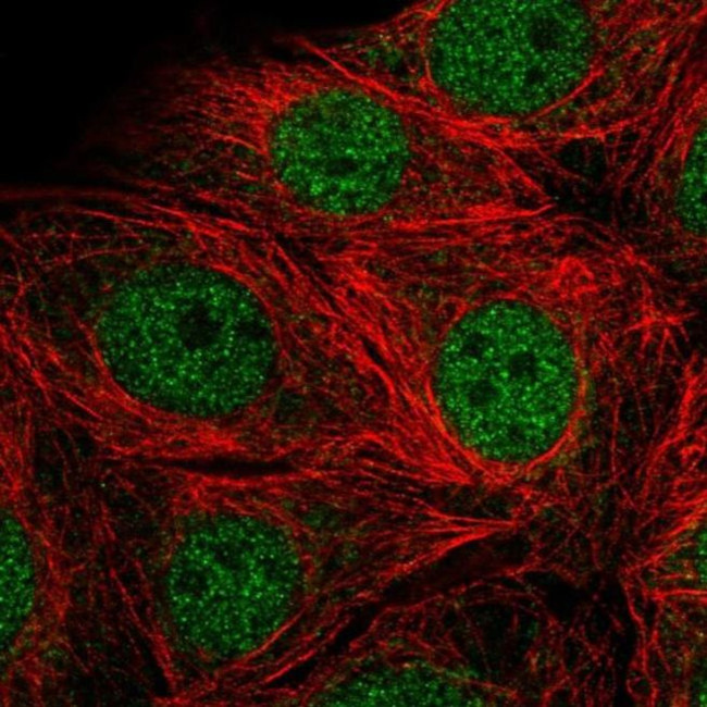SMARCD2 Antibody in Immunocytochemistry (ICC/IF)