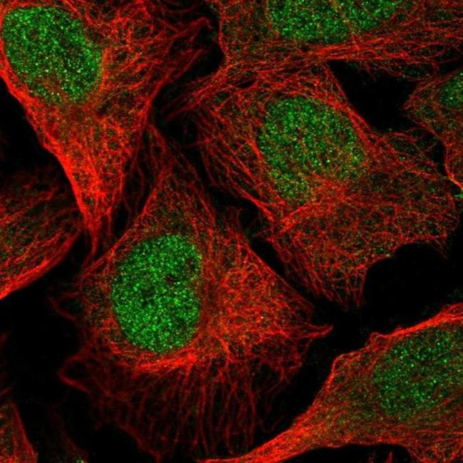 C5orf28 Antibody in Immunocytochemistry (ICC/IF)