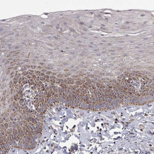 MRPL3 Antibody in Immunohistochemistry (IHC)