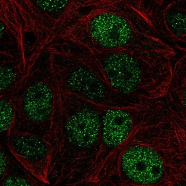 ZHX1 Antibody in Immunocytochemistry (ICC/IF)
