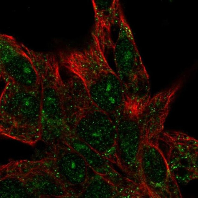 CENPBD1 Antibody in Immunocytochemistry (ICC/IF)