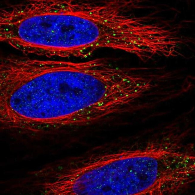 TLL1 Antibody in Immunocytochemistry (ICC/IF)