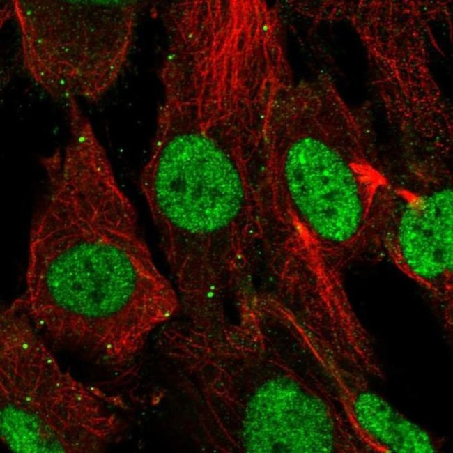SHOX Antibody in Immunocytochemistry (ICC/IF)