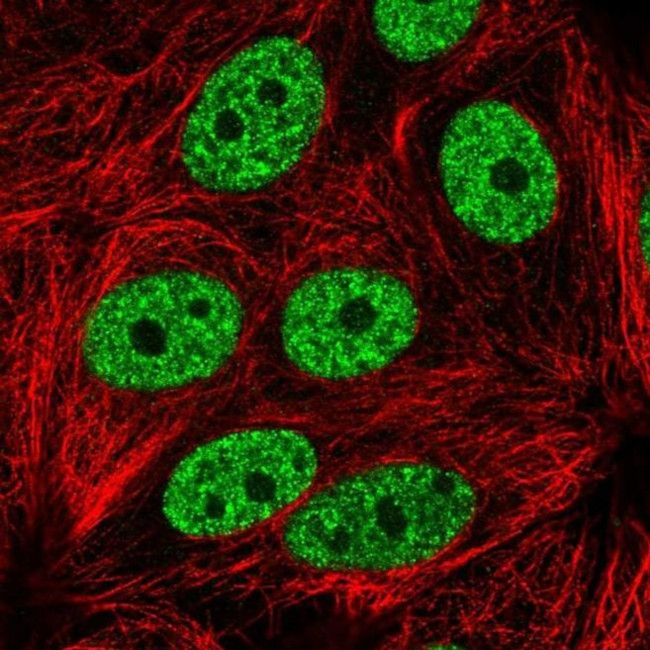 YLPM1 Antibody in Immunocytochemistry (ICC/IF)