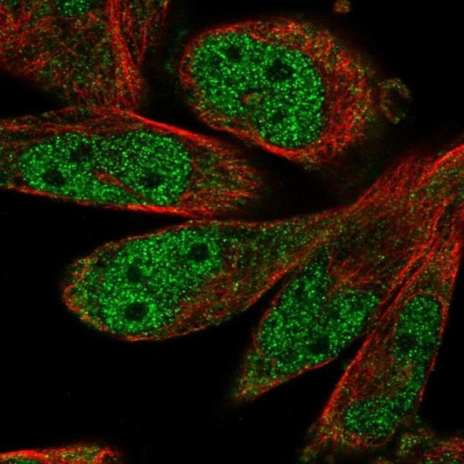 SCAPER Antibody in Immunocytochemistry (ICC/IF)