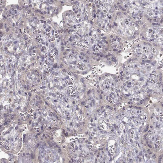 CRB1 Antibody in Immunohistochemistry (Paraffin) (IHC (P))