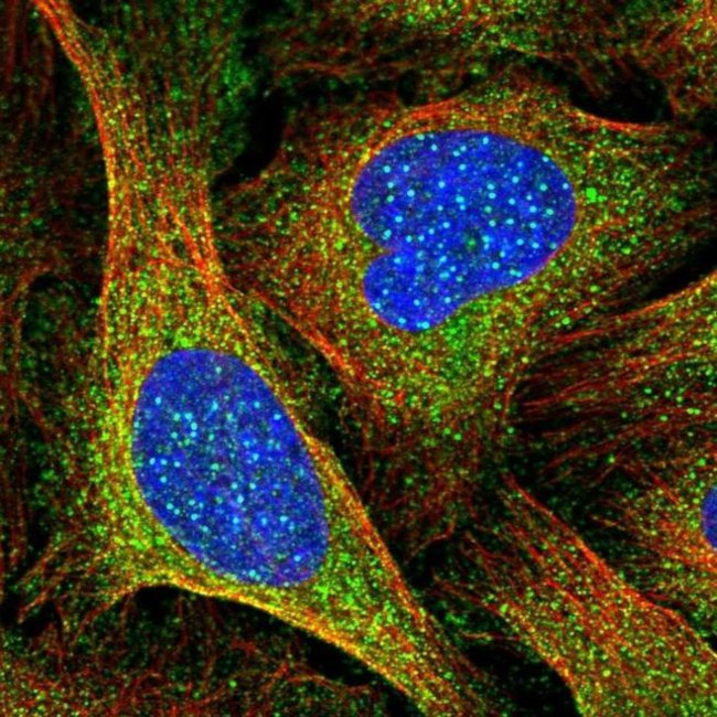 CENPI Antibody in Immunocytochemistry (ICC/IF)