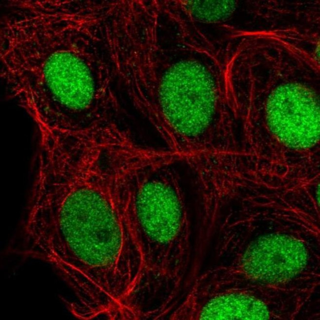 C14orf4 Antibody in Immunocytochemistry (ICC/IF)