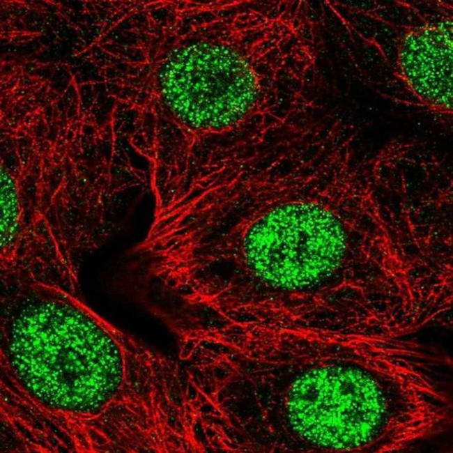 SMARCD2 Antibody in Immunocytochemistry (ICC/IF)