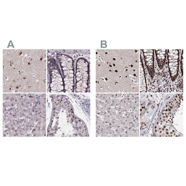 SR140 Antibody in Immunohistochemistry (IHC)