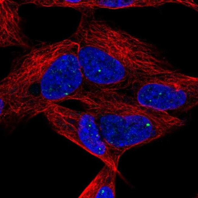 DLX6 Antibody in Immunocytochemistry (ICC/IF)